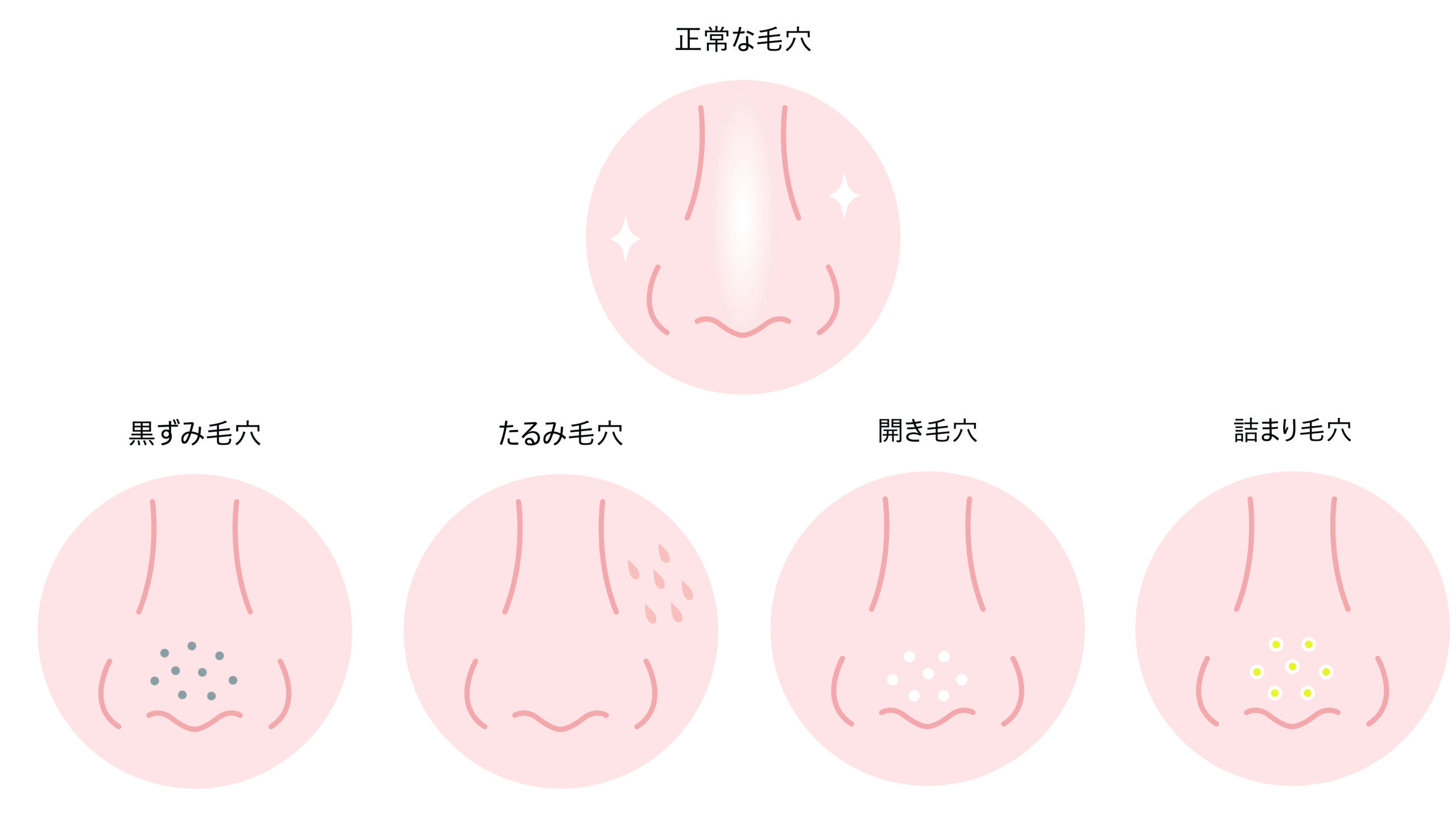 毛穴の種類